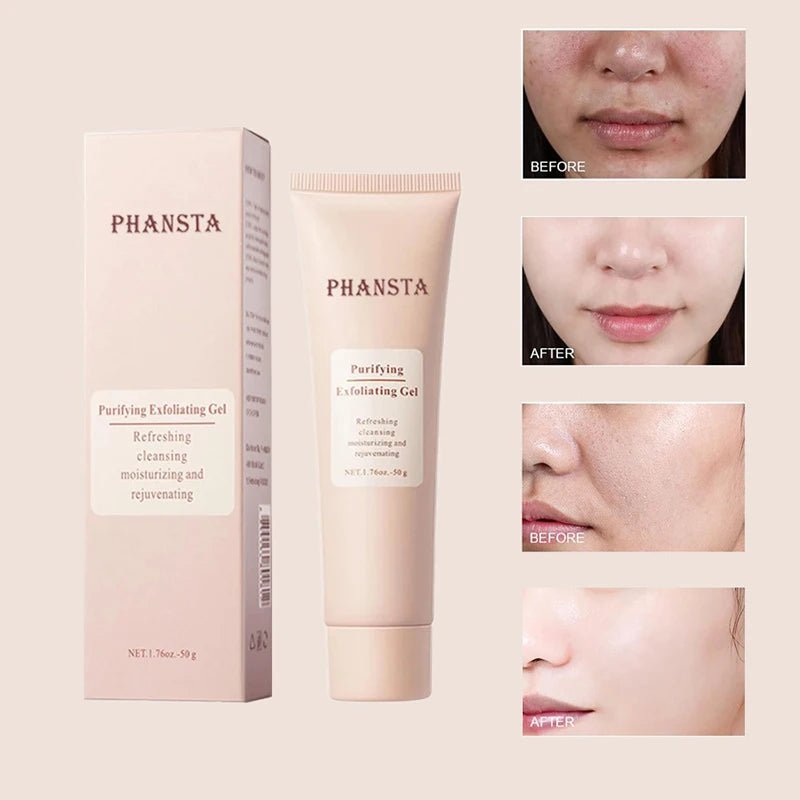 Pore Purifying Exfoliating Gel - Smooth & Radiant Skin - 4USelects