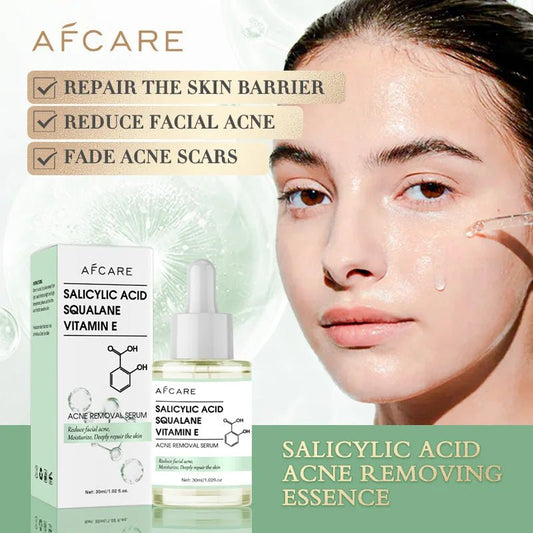 Radiant Glow Anti - Acne Face Serum with Salicylic Acid - 4USelects