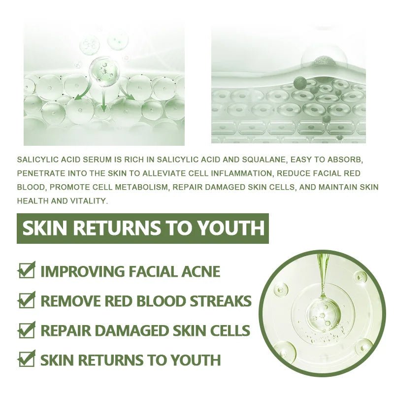 Radiant Glow Anti - Acne Face Serum with Salicylic Acid - 4USelects