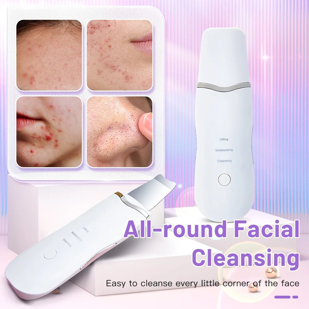 Ultrasonic Skin Scrubber & Blackhead Remover - 4USelects