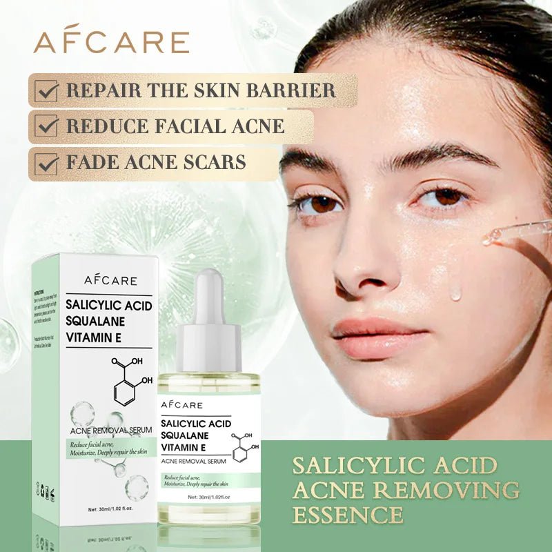 Radiant Glow Anti - Acne Face Serum with Salicylic Acid - 4USelects