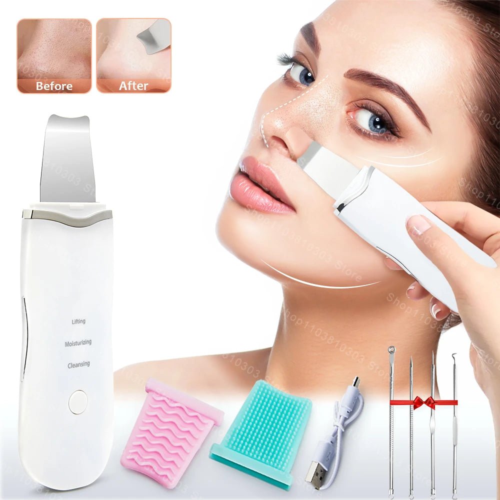 Ultrasonic Skin Scrubber & Blackhead Remover - 4USelects