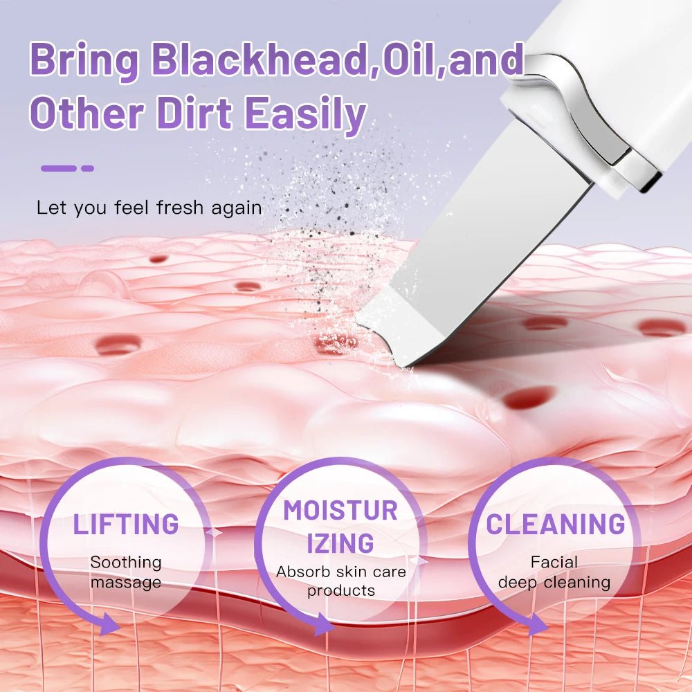 Ultrasonic Skin Scrubber & Blackhead Remover - 4USelects
